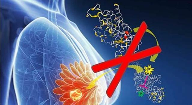 症状|得了乳腺癌，一般哪里会疼医生边辟谣边告诉您如何预防乳腺癌