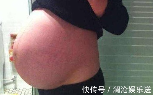 后生|孕妇十月怀胎后生下个“藏獒”,医生得知原因后,怒斥孕妇没人性