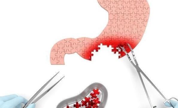 胃不好的人早上喝3水,有助于杀死幽门螺杆菌,还预防“胃癌”!