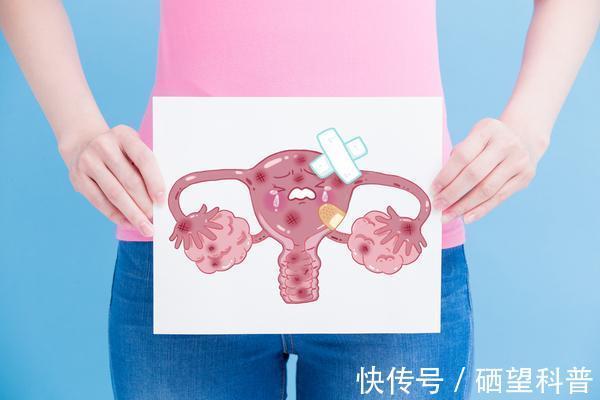 阴道炎|女人患有妇科病,脸上会有5种表现,若你一个也没有,说明很健康