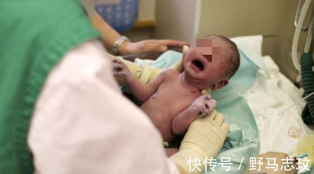 分娩|顺产虽然比剖腹产恢复快,但是剖腹产有三个好处,顺产比不了