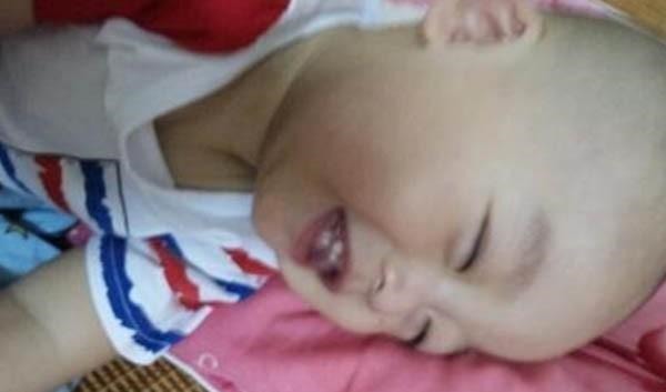 大人们|孩子睡觉总是咧着嘴笑,父母带娃去医院检查,医生:幸亏来得及时