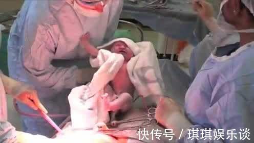 护士|剖腹产后最痛的一个护理环节!护士喜欢做,产妇见了就害怕