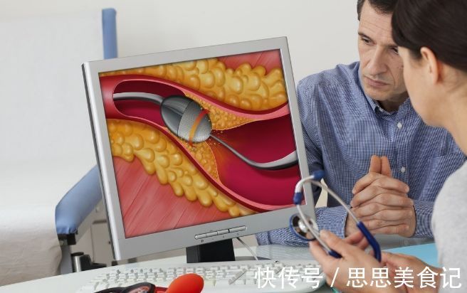 生命高危期|45岁后,步入生命高危期,想健康,保持2净、3软,坚持4勤