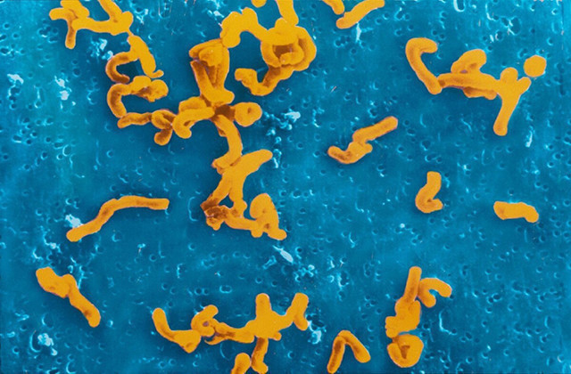 保护剂|胃黏膜“保护剂”开水里撒一把，灭菌养胃，杀灭幽门螺杆菌