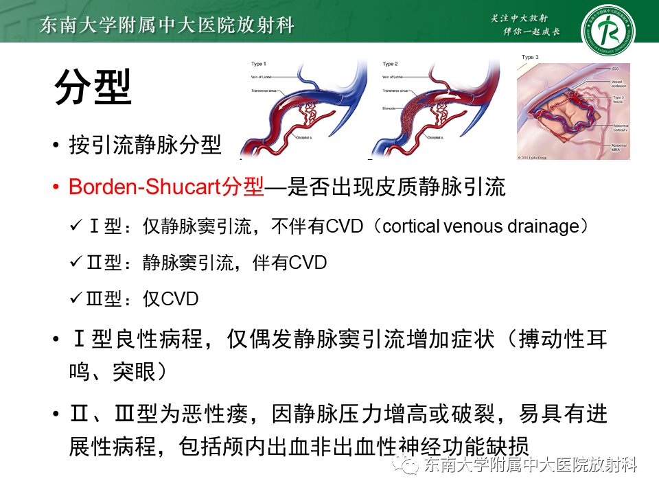 影像学|脑动静脉畸形影像学特征