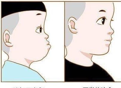 舌头|孩子牙不齐,多半是这4个坏习惯引起的,希望你家孩子一个都没有