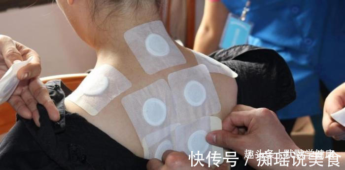 三伏贴|冬病夏治抓住一年中养阳的40天,阳虚的人记得提前安排好3件事