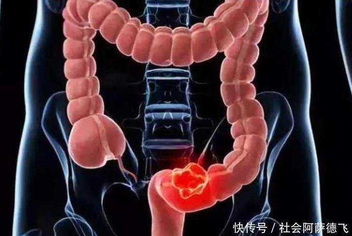 冬至清肠正当时,隔三差五吃,便秘没了,排出毒素,体重降得快