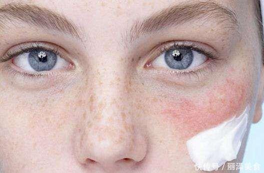 护肤品不要乱使用，这样可能会伤皮肤