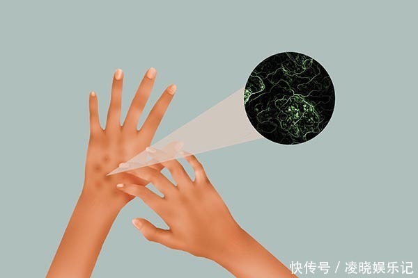 雌激素|维生素E内服好还是外用好?有什么区别?别用错了