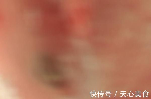 纽扣电池|男童好奇误吞纽扣电池后送医,家长觉得没大碍直接抱回家