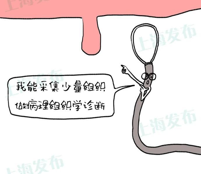 麻醉|【医聊】肠息肉是怎么长出来的？要不要割？