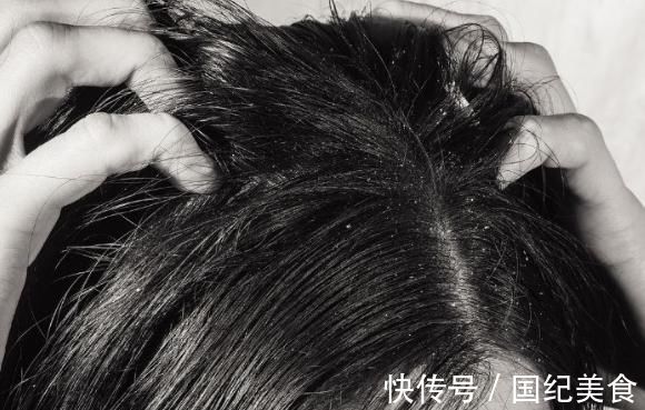 葛根|肝好不好看头就知，头发出现3种“异常”，说明肝脏已不健康了！