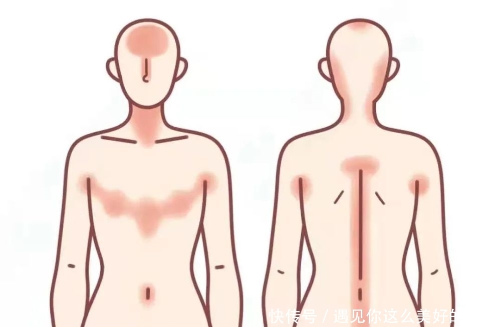 你重金呵护的脸,为何总不如手和身体白嫩?