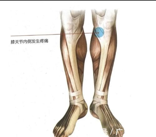 损伤|跑1万步是最合适的运动量吗？会不会对膝盖造成损伤？