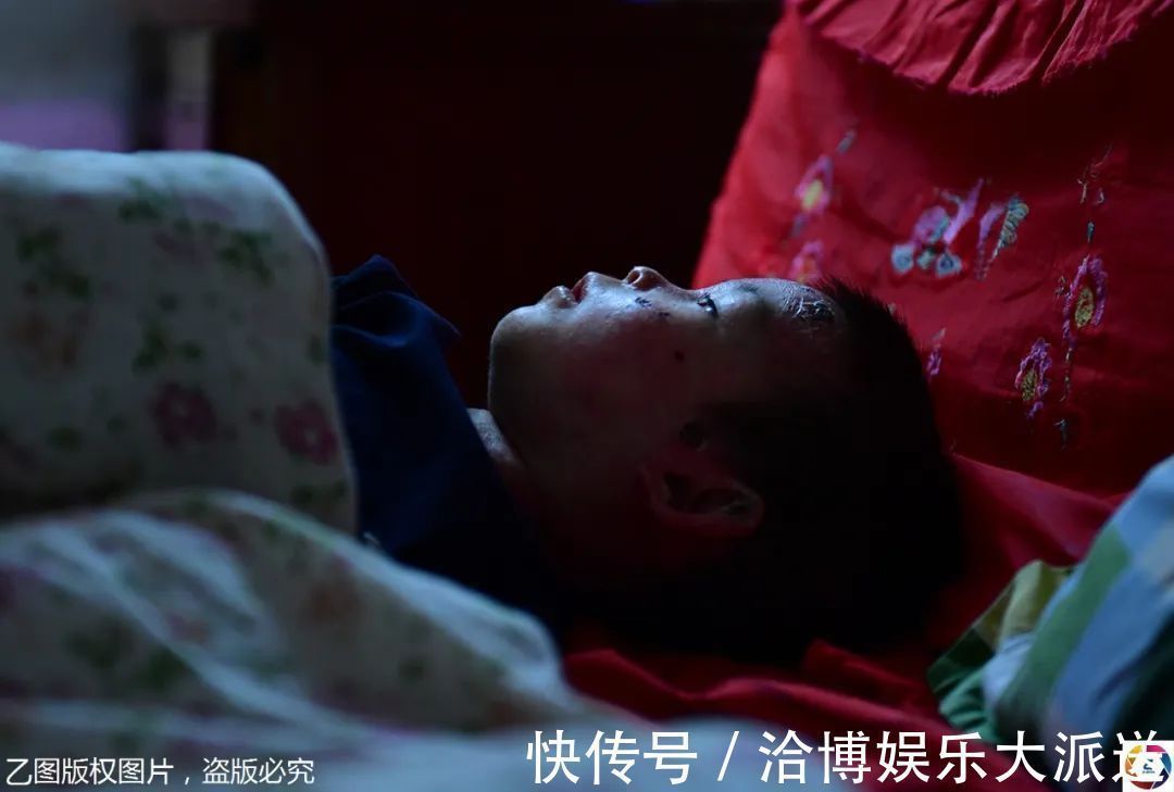 纱布|男童出生患罕见病，三年用掉纱布5000多圈，每天只能坐在床上