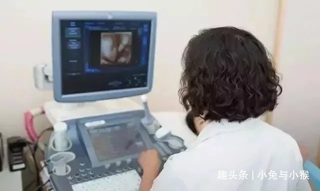 四维彩超套近乎,想得到点“关键信息”,孕妈们产检目的别错了!