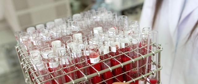 A型ab型小孩什么血型 A型ab型小孩什么血型