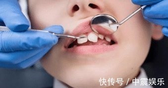 牙齿|宝宝的牙齿问题多又多,快来看看这几种解决方法吧