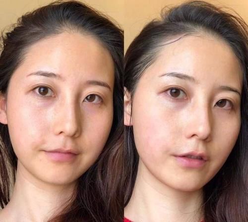 下垂|女人开始衰老时，脸上有哪些变化？少吃3类食物，或可延缓衰老