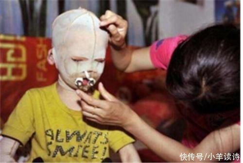 五花马千金裘|女孩一直戴着头套上学，被同学嘲笑，当她摘下头套后，众人沉默了