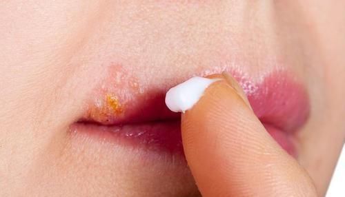 透过“唇色”看健康，嘴唇出现这六种现象，提示疾病已经“临门”