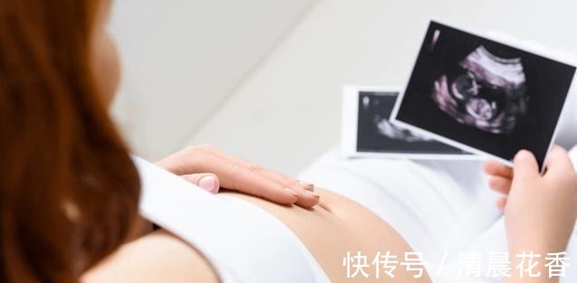 宝宝|做四维时宝宝趴着不愿意动,原来是这些原因,做好这点一次通过