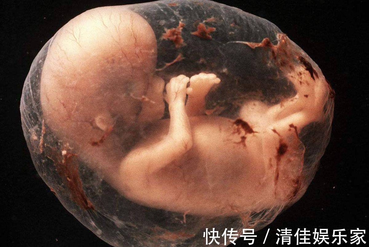 排泄物|胎儿在母亲肚子里，生活的很“精致”！不过他的大小便都去哪了