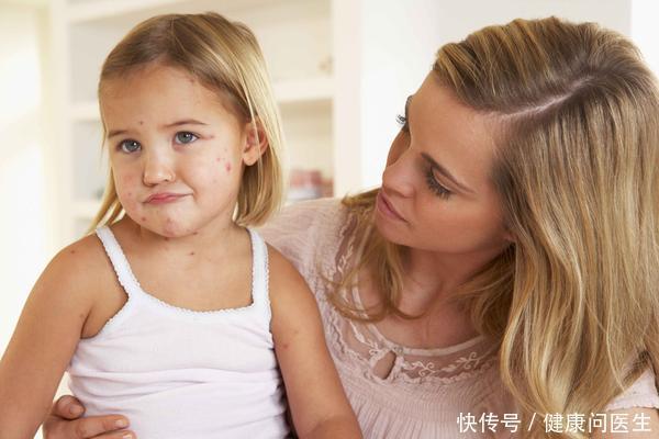 疱疹性咽峡炎|现在疱疹性咽峡炎多发,家长如何应对,预防孩子不中招