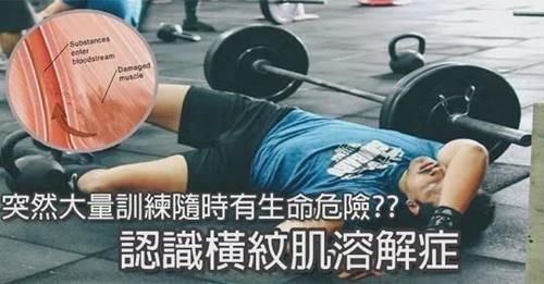 横纹肌溶解症|拒绝夏季疯狂锻炼,运动需适度,不要盲目健身!