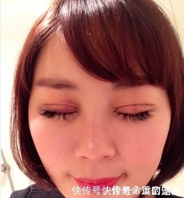 割双眼皮和天生双眼皮的人有什么不同,现在知道还不晚