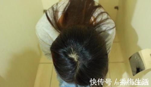 子宫内膜|子宫内膜癌到来时,早期身体会有提醒,女性多留意,别拖延