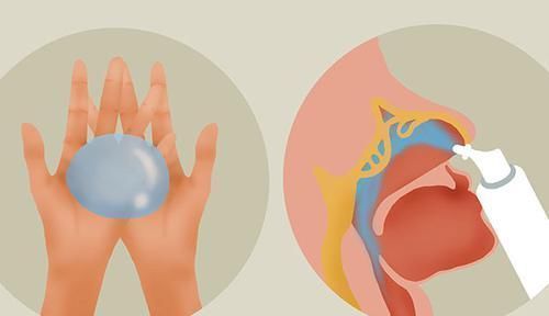 打呼噜|秋季防鼻炎：注意4个症状，做好2件事，过敏性鼻炎难复发