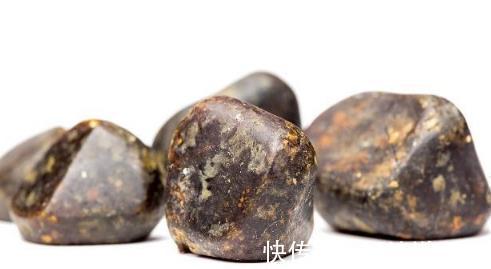 治疗|体内有“胆结石”的人,大多数有以下几个表现,切勿忽视