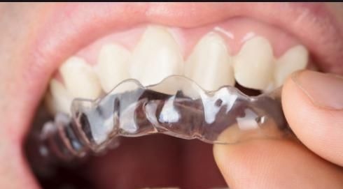 牙医|孩子换牙齿,新长的牙齿却是歪的,可能是家长这些没做好