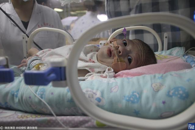 保温箱|泪目!女子求助无门欲拔掉娃的氧气时,孩子突然伸手给她擦眼泪