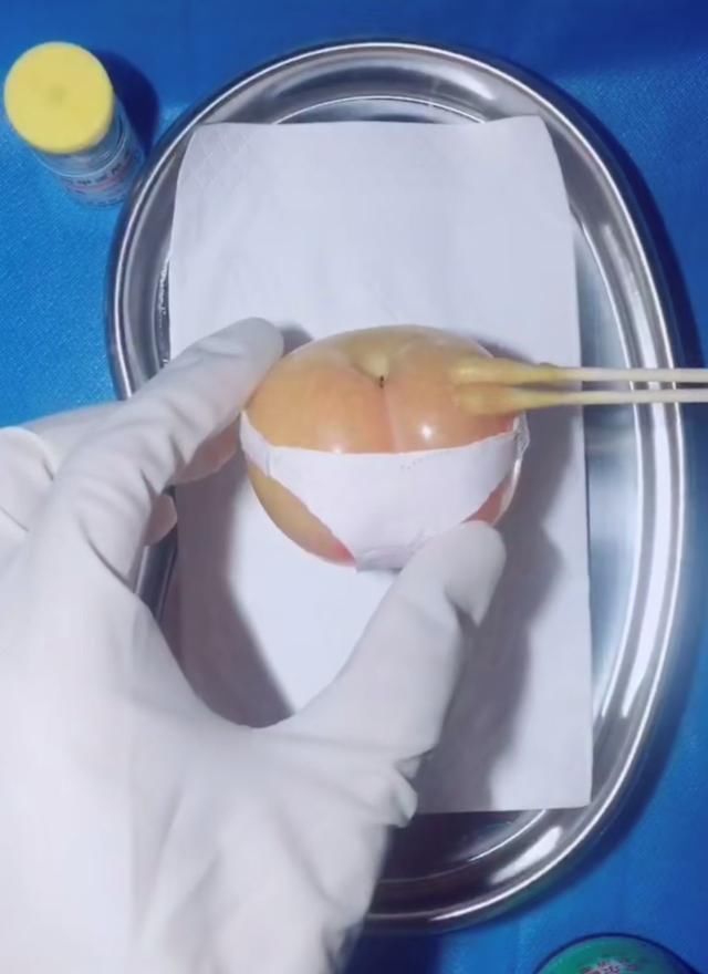 手术|给火龙果割阑尾33岁水果医生爆红吸粉90万网友看到第一个就痛了
