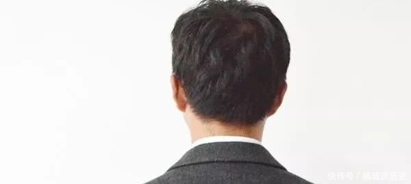 背部|每天趴地三分钟,多年的驼背好了?一个月后还会有意料之外的好处