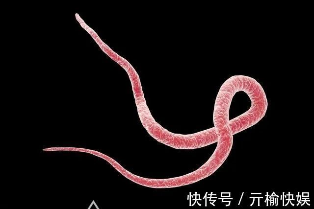 睡眠质量|若孩子肚子里有蛔虫,会出现这些“信号”,家长速查你家娃有吗