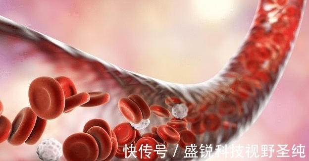 癌症|血常规能查出癌症吗?医生:“揪出”早期癌症,不要放过这3项