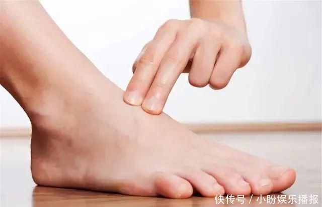 血管堵塞|血脂超标的人，鸡蛋可以吃，但这几类食物，请停止食用，切莫贪嘴