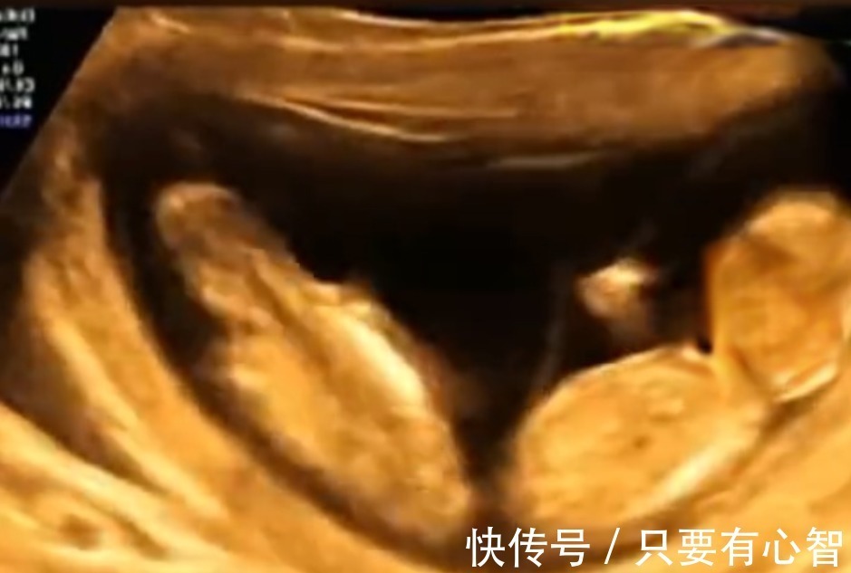 四维彩超|孕妈做四维彩超时突然腹痛,B超显示让人忍俊不禁,网友:挺无辜