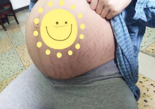 叶酸|女性最佳生育时间只六年？超过这个年龄，达到这些条件也可以