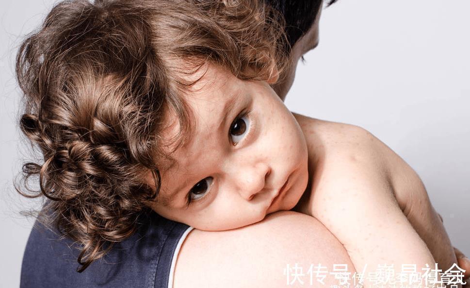 宝宝们|嗡嗡嗡,你听你听,蚊子在狰狞的笑,它最喜欢小宝宝