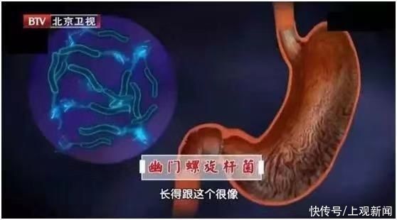 吃饭时的这5个坏习惯,会增加致癌、致死风险!