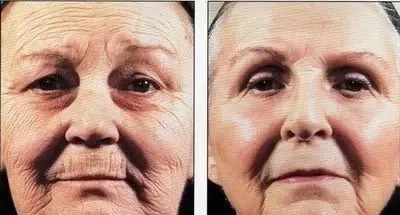 不要错过夏季护肤的最佳时期