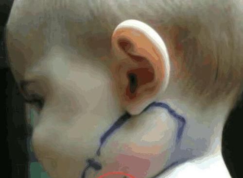 宝宝脖子长羽毛,家长当过敏治,医生说出原因家长吓出一身汗