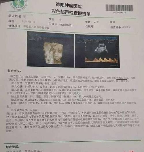 孕妈快看，孕检报告正常出生却没右臂，医院：愿担责30%