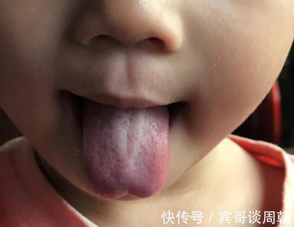 小食品|3种食物堪称积食“加速器”,想要孩子脾胃好,要让娃尽量避免